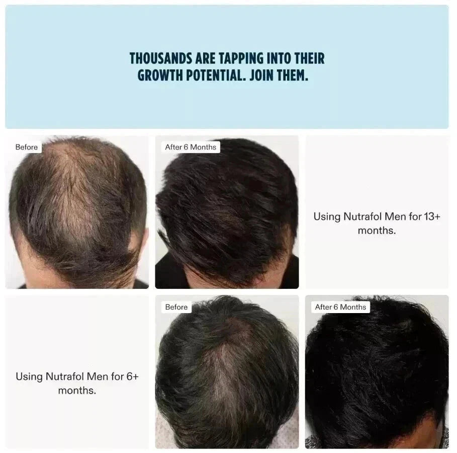 Neutrfal Men Hair Growth Nutraceuticals 120 Capsules | Hair Support Supplement